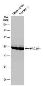 PACSIN1 Antibody in Western Blot (WB)
