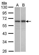 TNIP2 Antibody in Western Blot (WB)