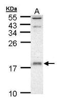 UBE2D1 Antibody in Western Blot (WB)
