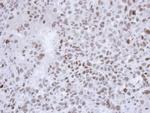 SALL4 Antibody in Immunohistochemistry (Paraffin) (IHC (P))