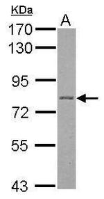 PKP1 Antibody in Western Blot (WB)