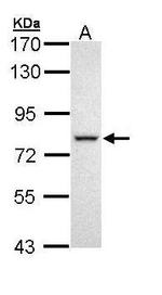DDX41 Antibody in Western Blot (WB)