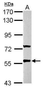 GABRR2 Antibody in Western Blot (WB)