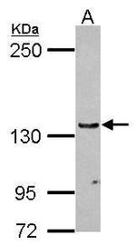 UPF1 Antibody in Western Blot (WB)