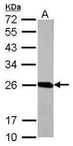 GSTP1 Antibody in Western Blot (WB)