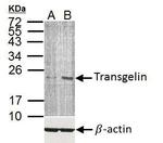 TAGLN Antibody in Western Blot (WB)