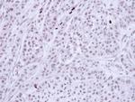 Bub3 Antibody in Immunohistochemistry (Paraffin) (IHC (P))