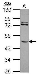 MMP8 Antibody in Western Blot (WB)
