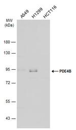 PDE4B Antibody in Western Blot (WB)