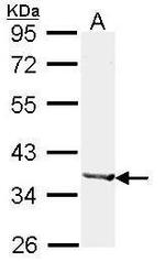 Alcohol Dehydrogenase 1B Antibody in Western Blot (WB)