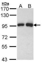 Gelsolin Antibody in Western Blot (WB)