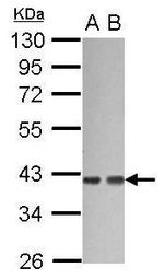 GNA12 Antibody in Western Blot (WB)
