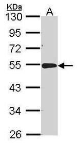 Acid Phosphatase 2 Antibody in Western Blot (WB)