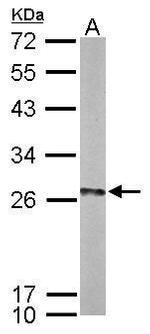 HIP2 Antibody in Western Blot (WB)