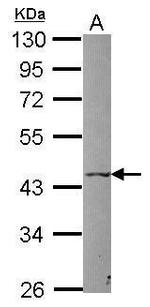 P2X5 Antibody in Western Blot (WB)