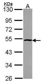 PSMC4 Antibody in Western Blot (WB)