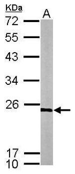 RPL9 Antibody in Western Blot (WB)