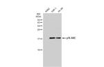 ARPC5 Antibody in Western Blot (WB)