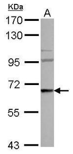 WASF3 Antibody in Western Blot (WB)