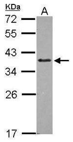 ZNF346 Antibody in Western Blot (WB)