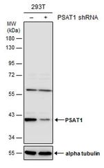 PSAT1 Antibody