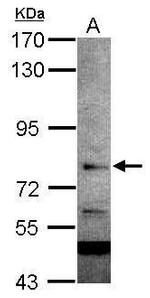 RC74 Antibody in Western Blot (WB)