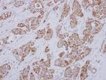SLC25A23 Antibody in Immunohistochemistry (Paraffin) (IHC (P))