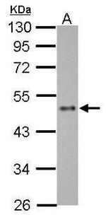 ZNF71 Antibody in Western Blot (WB)