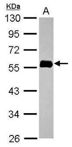 NORE1 Antibody in Western Blot (WB)