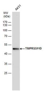 TMPRSS11D Antibody in Western Blot (WB)