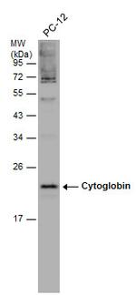 Cytoglobin Antibody in Western Blot (WB)