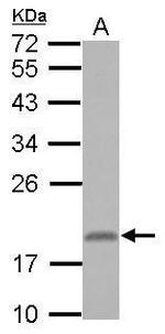 RNF181 Antibody in Western Blot (WB)