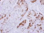NDRG4 Antibody in Immunohistochemistry (Paraffin) (IHC (P))