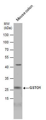 GST Omega 1 140A Antibody in Western Blot (WB)