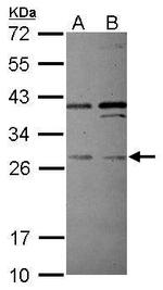 PLEKHF2 Antibody in Western Blot (WB)