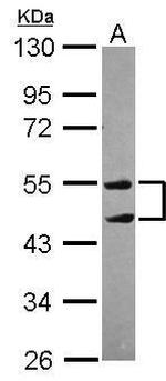 TRIM10 Antibody in Western Blot (WB)