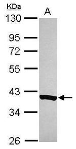 NDUFAF5 Antibody in Western Blot (WB)