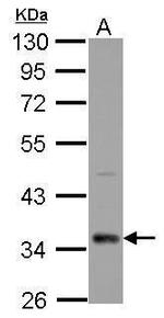 CPXCR1 Antibody in Western Blot (WB)