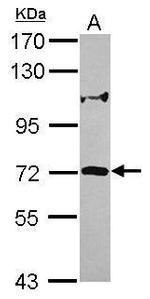 ZNF571 Antibody in Western Blot (WB)