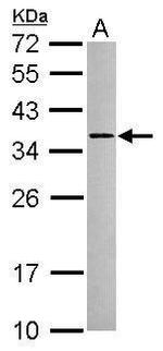 RSRP1 Antibody in Western Blot (WB)