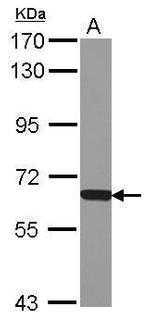 NAPRT1 Antibody in Western Blot (WB)