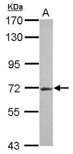 R3HDM2 Antibody in Western Blot (WB)