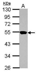 ZNF597 Antibody in Western Blot (WB)