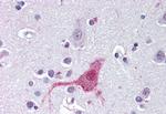 Endothelin B Receptor Antibody in Immunohistochemistry (Paraffin) (IHC (P))