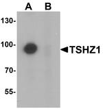 TSHZ1 Antibody in Western Blot (WB)