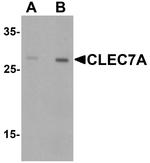Dectin 1 Antibody in Western Blot (WB)