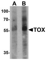 TOX Antibody in Western Blot (WB)