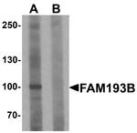FAM193B Antibody in Western Blot (WB)