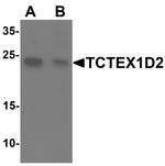 TCTEX1D2 Antibody in Western Blot (WB)
