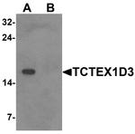 TCTEX1D3 Antibody in Western Blot (WB)